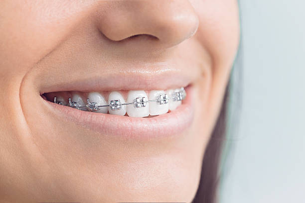 Best Teeth Whitening  in Franklin, WI